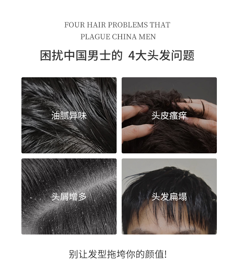 困擾中國男士的四大問題，油膩異味、頭皮瘙癢、頭屑增多、頭發(fā)扁塌